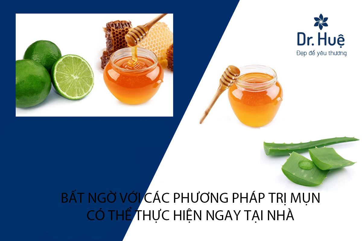 BẤT NGỜ VỚI CÁC PHƯƠNG PHÁP TRỊ MỤN CÓ THỂ THỰC HIỆN NGAY TẠI NHÀ