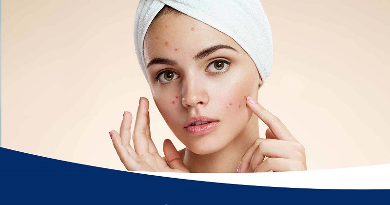 Cách điều trị mổ mụn bọc bị chai ở đâu tốt nhất tại TP.HCM