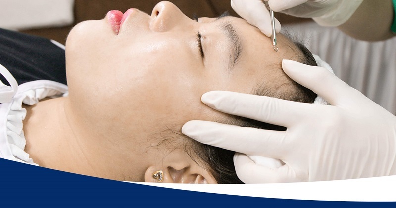 Có nên đi lấy nhân mụn không - Đi spa nặn mụn có tốt không