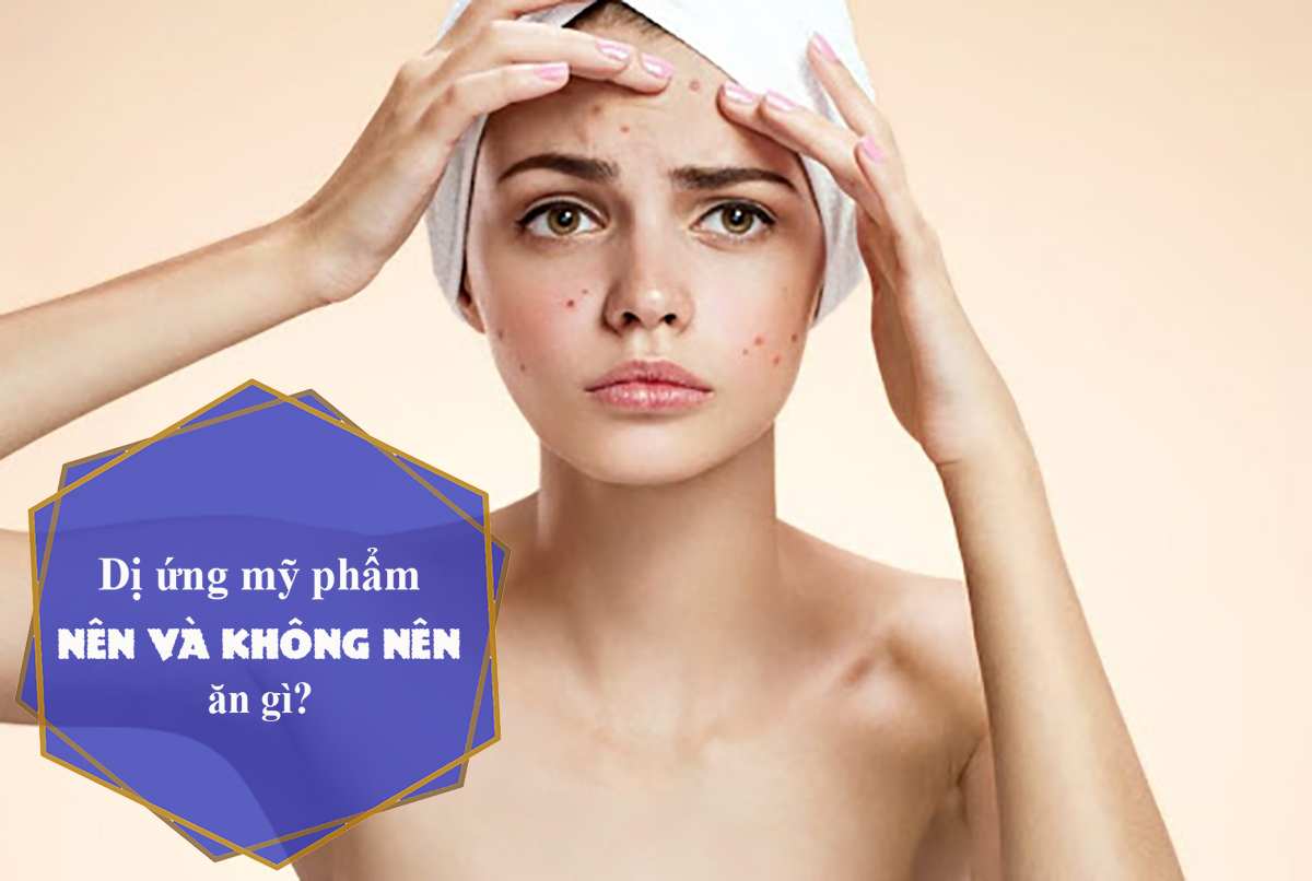 Dị ứng mỹ phẩm nên ăn gì để nhanh hết?