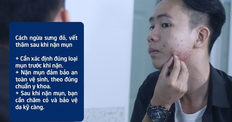 Làm gì sau khi nặn mụn để không bị thâm làm bớt sưng đỏ nhanh chóng