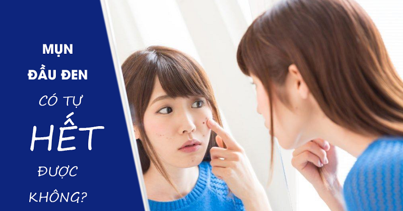 Mụn đầu đen có tự hết được không làm thế nào mới hết