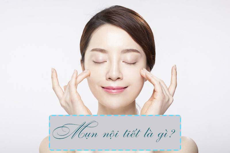 MỤN NỘI TIẾT LÀ GÌ, NGUYÊN NHÂN - CÁCH TRỊ VÀ NHỮNG ĐIỀU CẦN BIẾT
