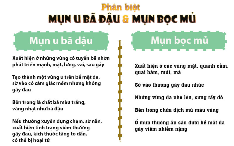 Mụn u bã đậu nguyên nhân và cách trị