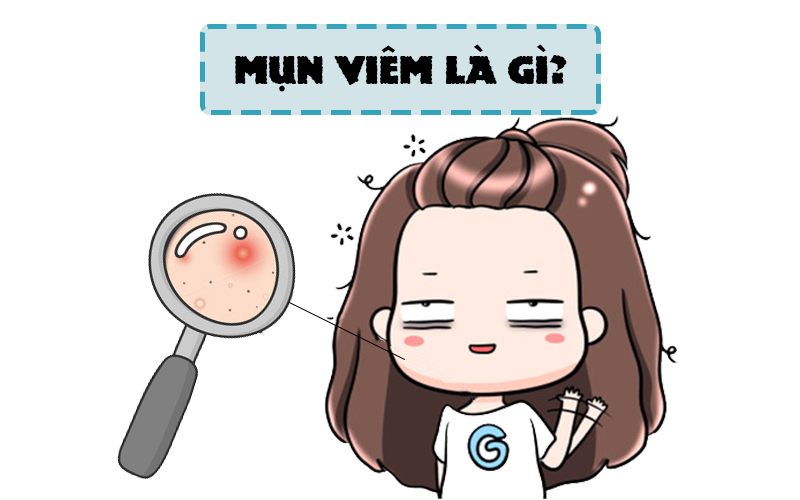 MỤN VIÊM LÀ GÌ, NGUYÊN NHÂN, CÁCH TRỊ VÀ NHỮNG ĐIỀU CẦN BIẾT