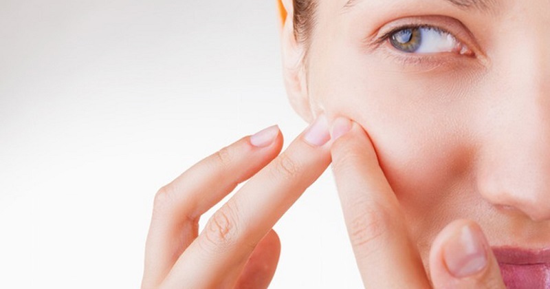 Nặn mụn bị tụ máu bầm thâm tím nên làm gì