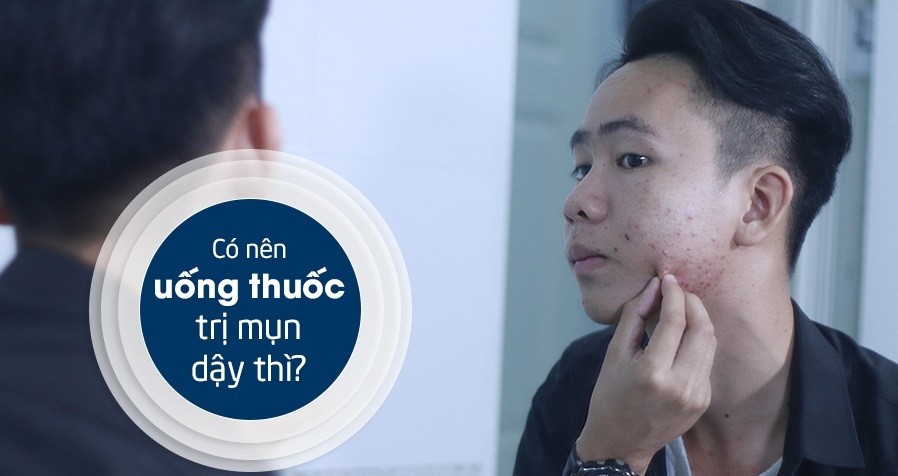Tổng hợp các loại thuốc uống trị mụn tuổi dậy thì tốt nhất hiện nay