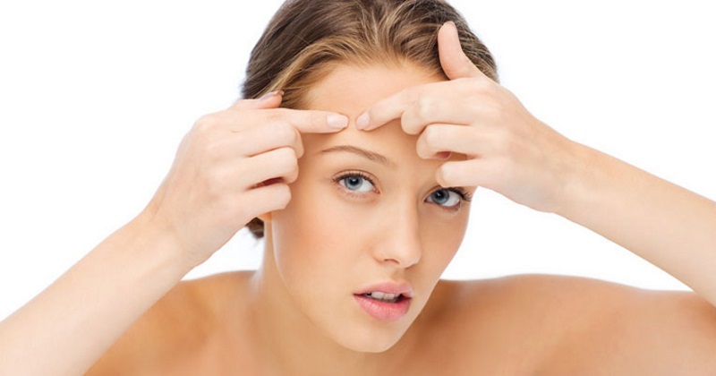 Tuổi dậy thì có nên nặn mụn không hay phải xử lý thế nào